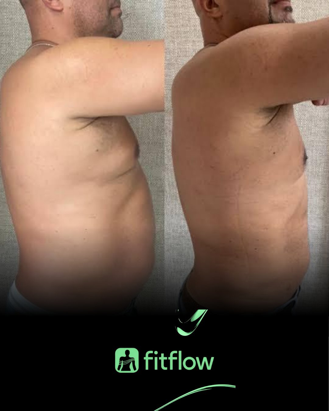 Antes e depois